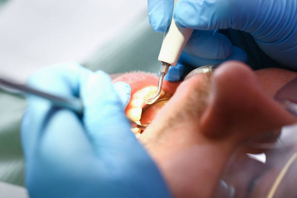 Best Weekend Emergency Dentist in Riverdale Park, CA