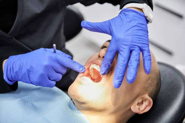 Best Emergency Dentist for Lost Fillings or Crowns in Riverdale Park, CA