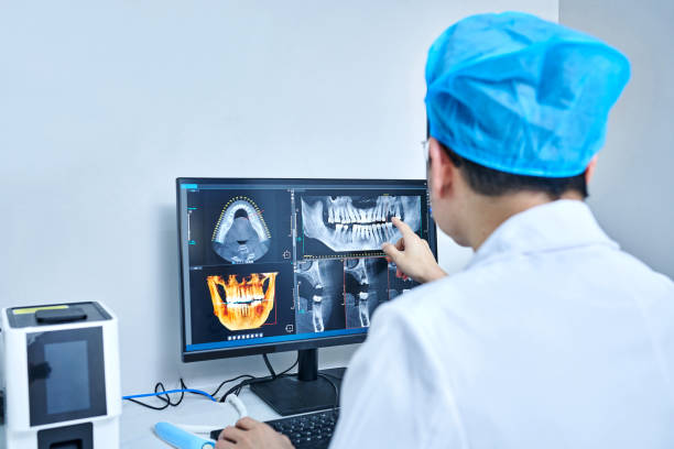 Best Emergency Dentist for Lost Fillings or Crowns in Riverdale Park, CA